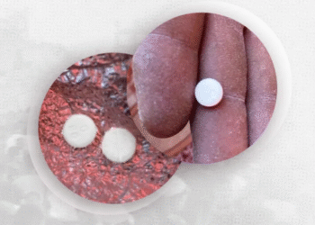 Pluhur Vdekjeje në Bukën e Ditës