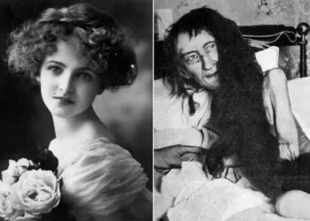 Historia e Blanche Monnier – Gruaja që u mbajt e mbyllur për 25 vite nga nëna e saj