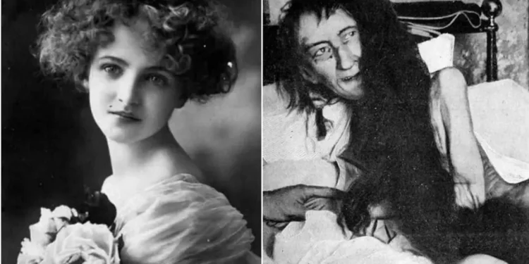 Historia e Blanche Monnier – Gruaja që u mbajt e mbyllur për 25 vite nga nëna e saj